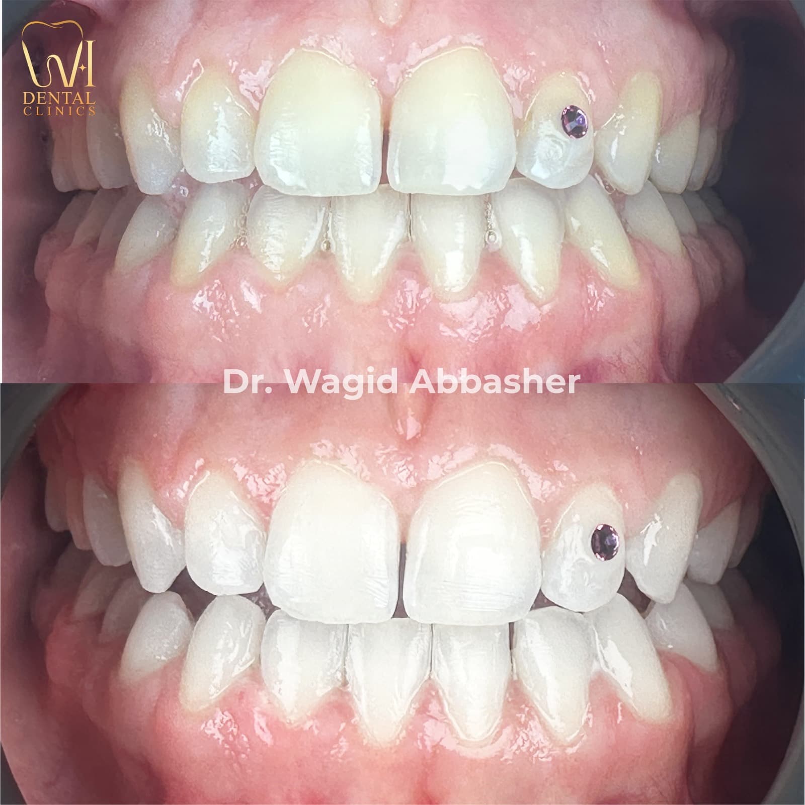 تجديدي وتجميلي — W.I للأسنان