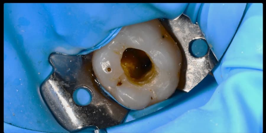 Restorative Dentistry before
