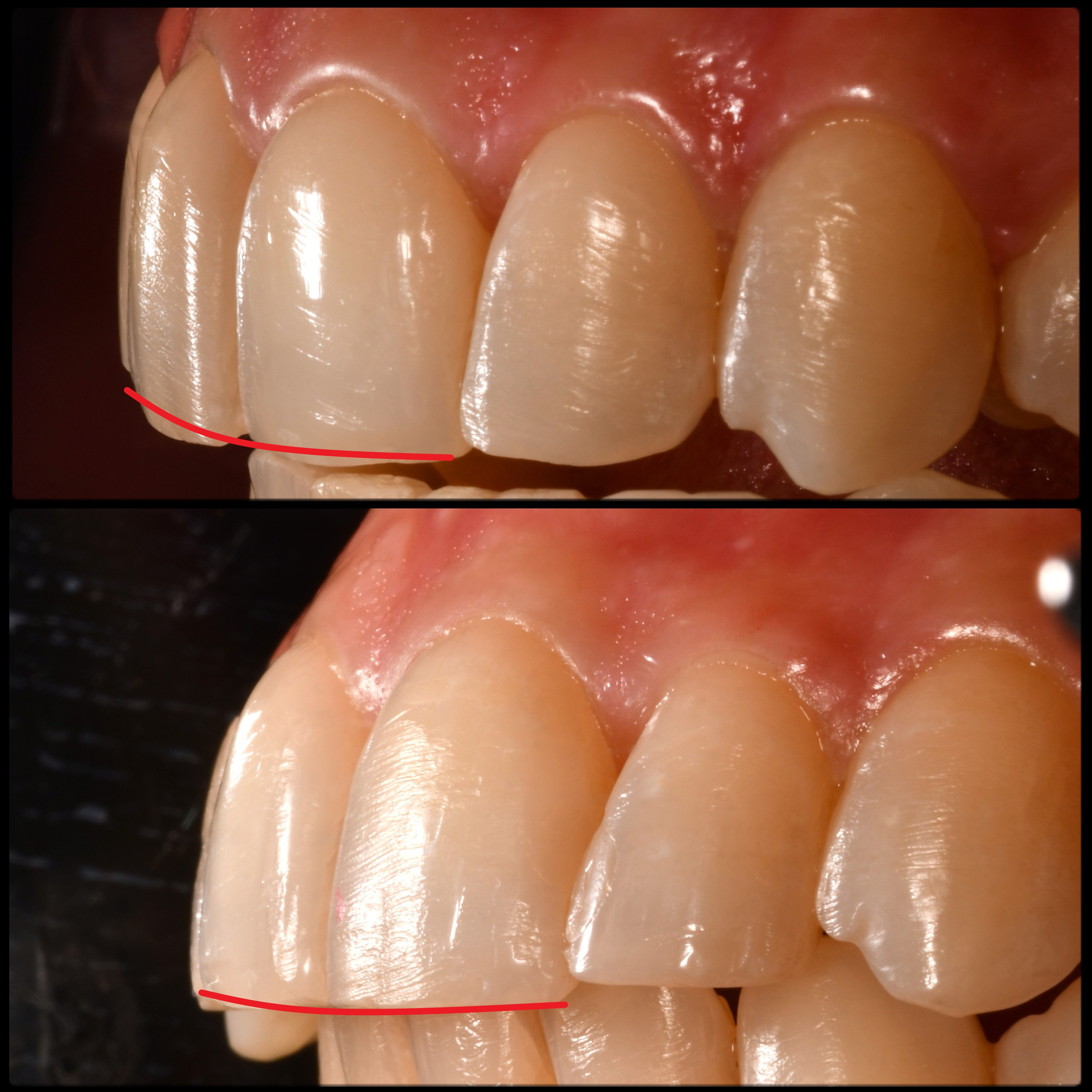 Restorative Dentistry before
